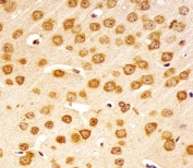 IHC testing of FFPE mouse brain tissue with Nr4a2 antibody. HIER: steam section in pH6 citrate buffer for 20 min and allow to cool prior to staining.