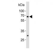 Western blot testing of mouse spleen tissue lysate with Gnl3 antibody. Predicted molecular weight ~61 kDa.