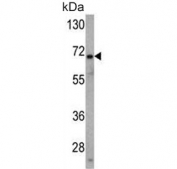Western blot testing of human HL60 cell lysate with USP2 antibody. Predicted molecular weight ~68 kDa.