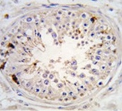 IHC testing of FFPE human testis tissue with USP2 antibody. HIER: steam section in pH6 citrate buffer for 20 min and allow to cool prior to staining.