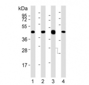 Western blot testing of mouse 1) brain, 2) liver, 3) heart and 4) testis tissue lysate with Utf1 antibody. Predicted molecular weight: 36 kDa, commonly observed molecular weight: 36-48 kDa.