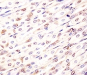 IHC testing of FFPE mouse stomach tissue with Med12 antibody. HIER: steam section in pH6 citrate buffer for 20 min and allow to cool prior to staining.