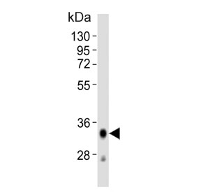 Western blot testing of human spleen tissue lysate with HLA-DQA1 antibody. Predicted molecular weight ~34 kDa.