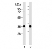 Western blot testing of human 1) Daudi and 2) Raji cell lysate with HLA-DQA1 antibody. Predicted molecular weight ~34 kDa.