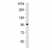 Western blot testing of human testis tissue lysate with USP13 antibody. Predicted molecular weight ~97 kDa.