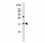Western blot testing of human SW480 cell lysate with KiSS-1 antibody. Predicted molecular weight ~15 kDa, commonly observed at 15-20 kDa.