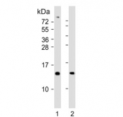 Western blot testing of human 1) placenta and 2) skeletal muscle tissue lysate with KiSS-1 antibody. Predicted molecular weight ~15 kDa, commonly observed at 15-20 kDa.