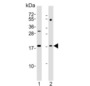 Western blot testing of human 1) HL60 and 2) Jurkat cell lysate with KiSS-1 antibody. Predicted molecular weight ~15 kDa, commonly observed at 15-20 kDa.