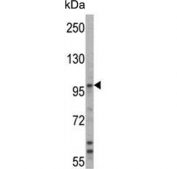 Western blot testing of human T-47D cell lysate with Ubiquitin-protein ligase E3A antibody. Predicted molecular weight ~100 kDa.
