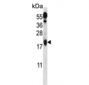 Western blot testing of mouse kidney tissue lysate with Ufm1-conjugating enzyme 1 antibody. Predicted molecular weight ~19 kDa.