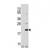 Western blot testing of 1) non-transfected and 2) transfected 293 cell lysate with Ufm1-conjugating enzyme 1 antibody.