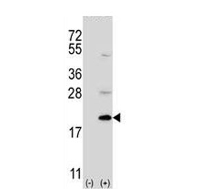Western blot testing of 1) non-transfected and 2) transfected 293 cell lysate with Ufm1-conjugating enzyme 1 antibody.