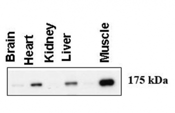 Western blot testing of human tissue lysate with Glycogen debranching enzyme antibody. Predicted molecular weight ~175 kDa. Data courtesy of Dr. Alan Cheng, Department of Internal Medicine, Life Sciences Institute, University of Michigan.