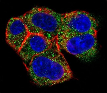 Immunofluorescent staining of human HepG2 cells with Glycogen debranching enzyme antibody (green), DAPI nuclear stain (blue) and anti-Actin (red).