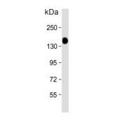Western blot testing of human skeletal muscle tissue lysate with Glycogen debranching enzyme antibody. Predicted molecular weight ~175 kDa.