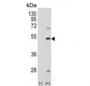 Western blot testing of 1) non-transfected and 2) transfected 293 cell lysate with Squalene synthase antibody.