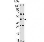 Western blot testing of human A375 in the absence (left) and presence (right) of immunizing peptide using Squalene synthase antibody. Predicted molecular weight ~48 kDa.