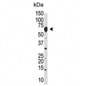 Western blot testing of mouse liver lysate with NUB1 antibody. Expected molecular weight: 70-100 kDa depending on level of ubiquitination. 