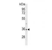 Western blot testing of human HEK293 cell lysate with SUMO-activating enzyme subunit 1 antibody. Predicted molecular weight ~38 kDa.
