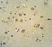 IHC testing of FFPE human brain tissue with ZIC3 antibody. HIER: steam section in pH6 citrate buffer for 20 min and allow to cool prior to staining.