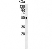 Western blot testing of human CCRF-CEM cell lysate with ZIC3 antibody. Predicted molecular weight ~51 kDa.