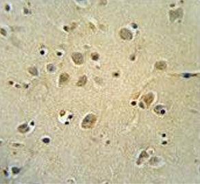 IHC testing of FFPE human brain tissue with ZIC3 antibody. HIER: steam section in pH6 citrate buffer for 20 min and allow to cool prior to staining.
