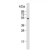 Western blot testing of human HL60 cell lysate with ZIC3 antibody. Predicted molecular weight ~51 kDa.