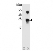Western blot testing of 1) non-transfected and 2) transfected 293 cell lysate with GADD45A antibody. Expected molecular weight: 14-18 kDa (monomer) and 28-36 kDa (dimer).