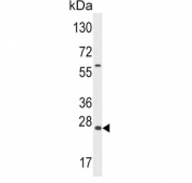 Western blot testing of Y79 cell lysate with GADD45A antibody. Expected molecular weight: 14-18 kDa (monomer) and 28-36 kDa (dimer).