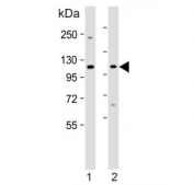Western blot testing of human 1) Jurkat and 2) K562 cell lysate with MTHFD1 antibody. Predicted molecular weight ~102 kDa.