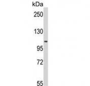 Western blot testing of human Y79 cell lysate with MTHFD1 antibody. Predicted molecular weight ~102 kDa.