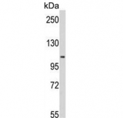 Western blot testing of human Y79 cell lysate with MTHFD1 antibody. Predicted molecular weight ~102 kDa.