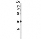 Western blot testing of Ramos cell lysate with U2AF1 antibody. Expected molecular weight: 28-35 kDa.