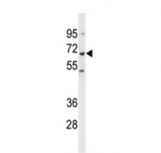 Western blot testing of human HL60 cell lysate with SHP-1 antibody. Predicted molecular weight ~68 kDa.