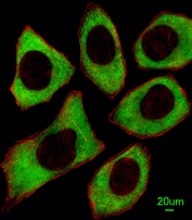 Immunofluorescent staining of human U-251 cells with SHP-1 antibody (green) and anti-Actin (red).