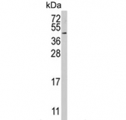 Western blot testing of human HeLa cell lysate with RFC5 antibody. Predicted molecular weight ~38 kDa.