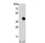 Western blot testing of 1) non-transfected and 2) transfected 293 cell lysate with RFC5 antibody.
