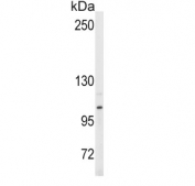 Western blot testing of human Y79 cell lysate with ENPP2 antibody. Expected molecular weight: 99-125 kDa depending on glycosylation level.