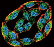 Immunofluorescent staining of human A2058 cells with HSPA8 antibody (green), DAPI nuclear stain (blue) and anti-Actin (red).