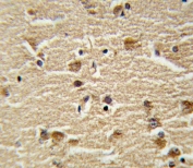 IHC testing of FFPE human brain tissue with HSPA8 antibody. HIER: steam section in pH6 citrate buffer for 20 min and allow to cool prior to staining.
