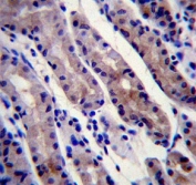 IHC testing of FFPE human stomach tissue with HSC70 antibody. HIER: steam section in pH6 citrate buffer for 20 min and allow to cool prior to staining.