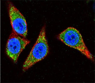 Immunofluorescent staining of human HeLa cells with Alpha Enolase antibody (green), DAPI nuclear stain (blue) and anti-Actin (red).