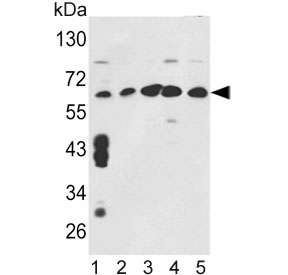 Western blot testing of human 1) MCF7, 2) CCRF-CEM, 3) K562, 4) HL60 and 5) HeLa cell lysate with TCP1 gamma antibody. Predicted molecular weight ~61 kDa.