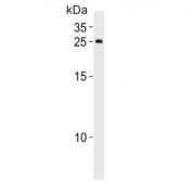 Western blot testing of human A2058 cell lysate with Adenine phosphoribosyltransferase antibody. Predicted molecular weight ~20 kDa.
