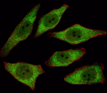 Immunofluorescent staining of fixed and permeabilized human A549 cells with Adenine phosphoribosyltransferase antibody (green) and anti-Actin (red).