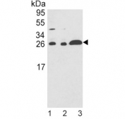 Western blot testing of human 1) A375, 2) HL60 and 3) Ramos cell lysate with ARHGDIA antibody. Expected molecular weight: 23-29 kDa.
