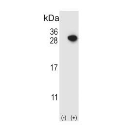 Western blot testing of 1) non-transfected and 2) transfected 293 cell lysate with ARHGDIA antibody.