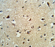 IHC testing of FFPE human brain tissue with ARHGDIA antibody. HIER: steam section in pH6 citrate buffer for 20 min and allow to cool prior to staining.