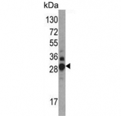Western blot testing of mouse kidney tissue lysate with Dimethylargininase 1 antibody. Expected molecular weight: 31-38 kDa.