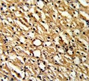 IHC testing of FFPE mouse kidney tissue with Dimethylargininase 1 antibody. HIER: steam section in pH6 citrate buffer for 20 min and allow to cool prior to staining.